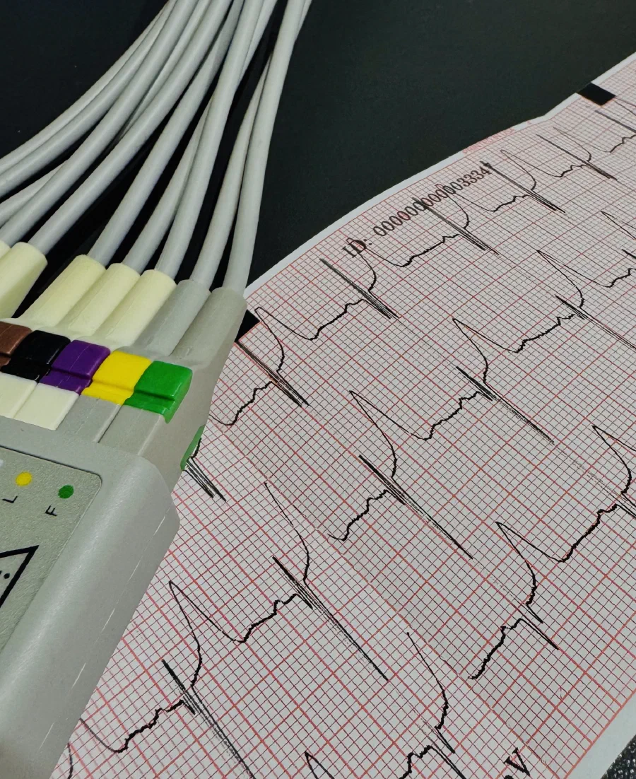 EKG-Ausdruck mit angeschlossenen Elektrodenkabeln